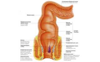 Внутренний геморрой: причины и симптомы