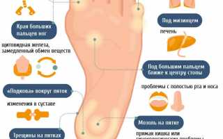 Почему болят стопы ног после сна?