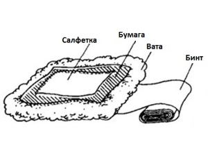 Схема компресса