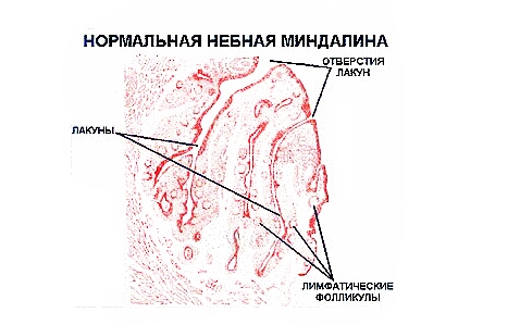 Строение небной миндалины 