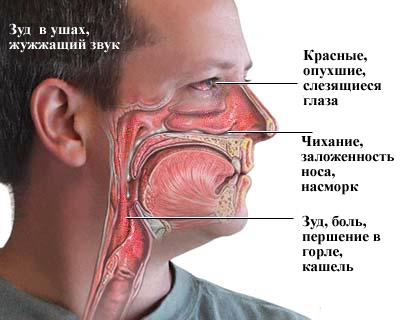 Признаки аллергии