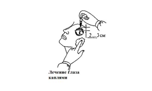 Схема закапывания глаз