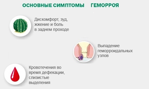 Если вы заметили у себя симптомы геморроя, то надо обратиться к проктологу